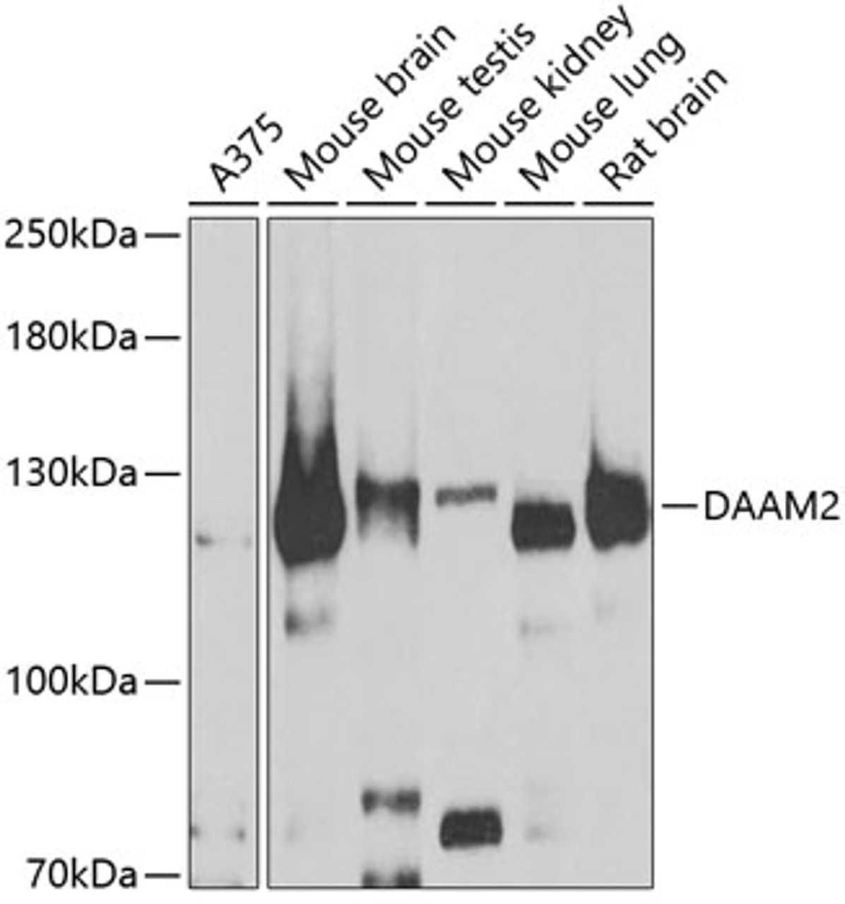 Western blot analysis of extracts of various cell lines, using DAAM2 antibody (22-959) at 1:1000 dilution.<br/>Secondary antibody: HRP Goat Anti-Rabbit IgG (H+L) at 1:10000 dilution.<br/>Lysates/proteins: 25ug per lane.<br/>Blocking buffer: 3% nonfat dry milk in TBST.<br/>Detection: ECL Basic Kit.<br/>Exposure time: 90s.