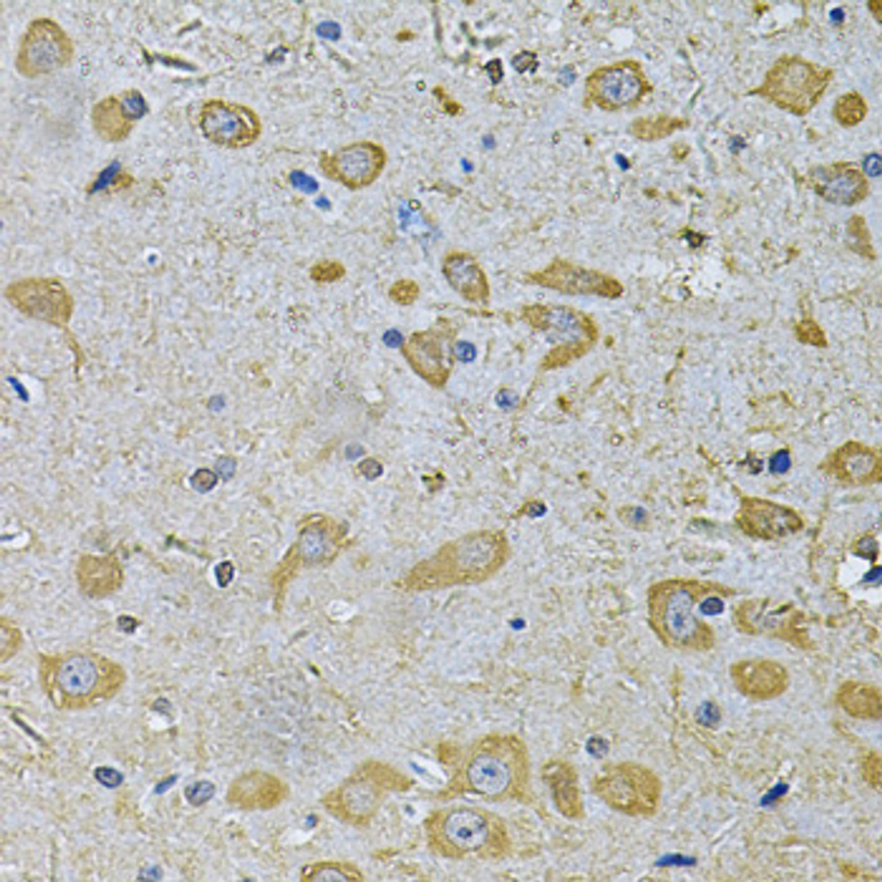 Immunohistochemistry of paraffin-embedded rat brain using DAAM2 Antibody (22-959) at dilution of 1:100 (40x lens) .