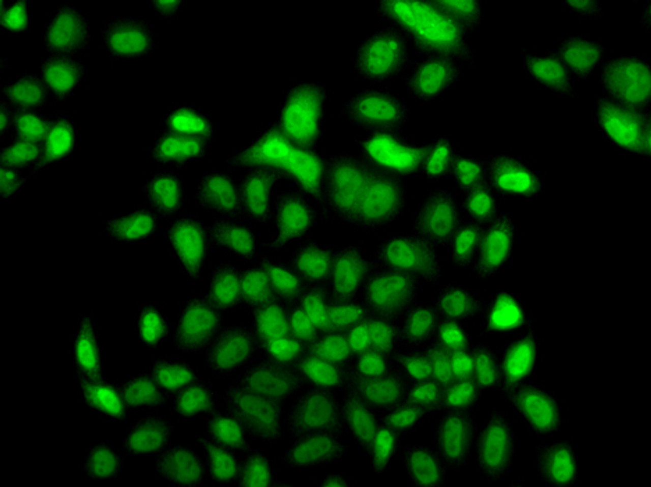 Immunofluorescence analysis of A549 cells using FBXO7 antibody (22-960) .
