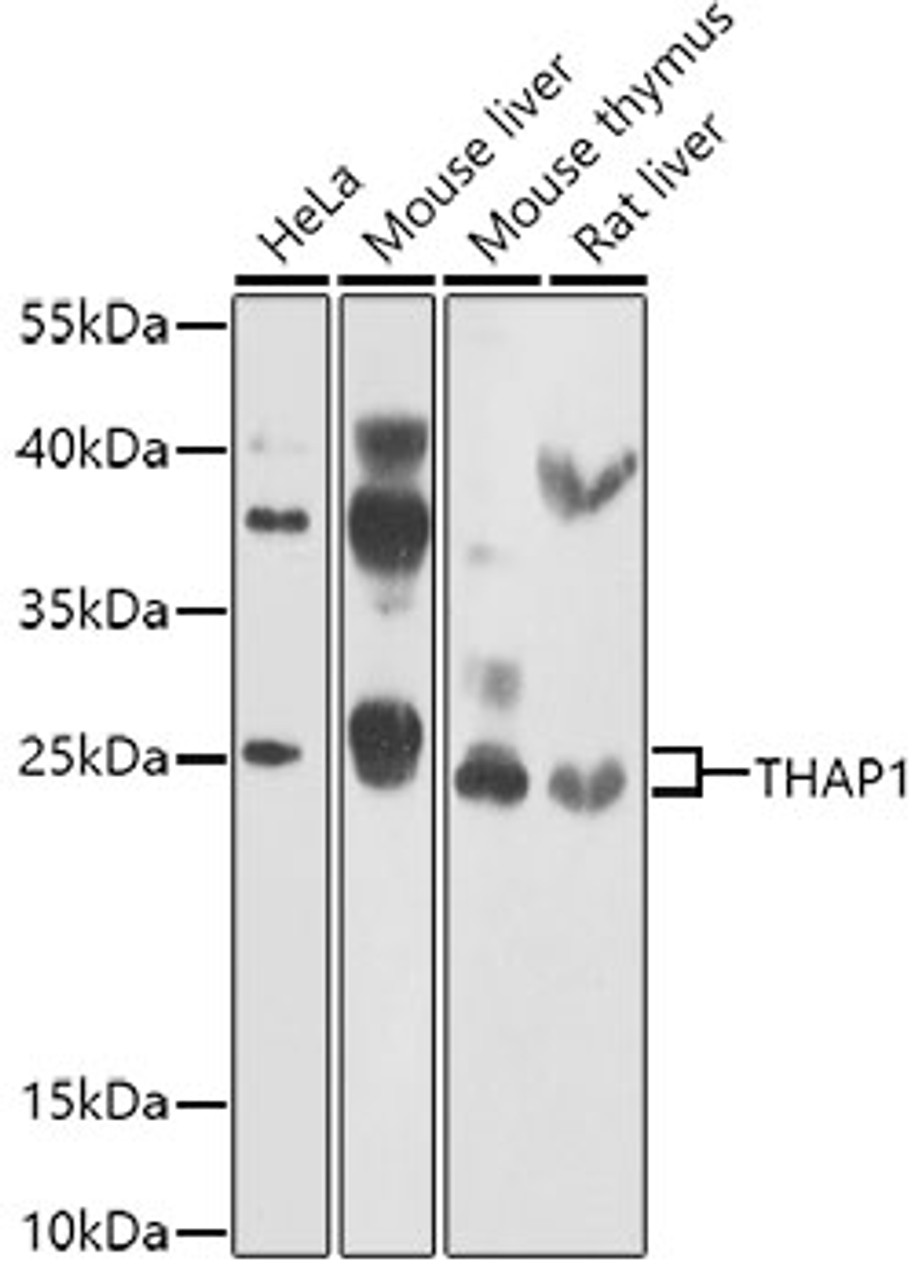 Western blot analysis of extracts of various cell lines, using THAP1 antibody (22-964) at 1:1000 dilution.<br/>Secondary antibody: HRP Goat Anti-Rabbit IgG (H+L) at 1:10000 dilution.<br/>Lysates/proteins: 25ug per lane.<br/>Blocking buffer: 3% nonfat dry milk in TBST.<br/>Detection: ECL Enhanced Kit.<br/>Exposure time: 30s.