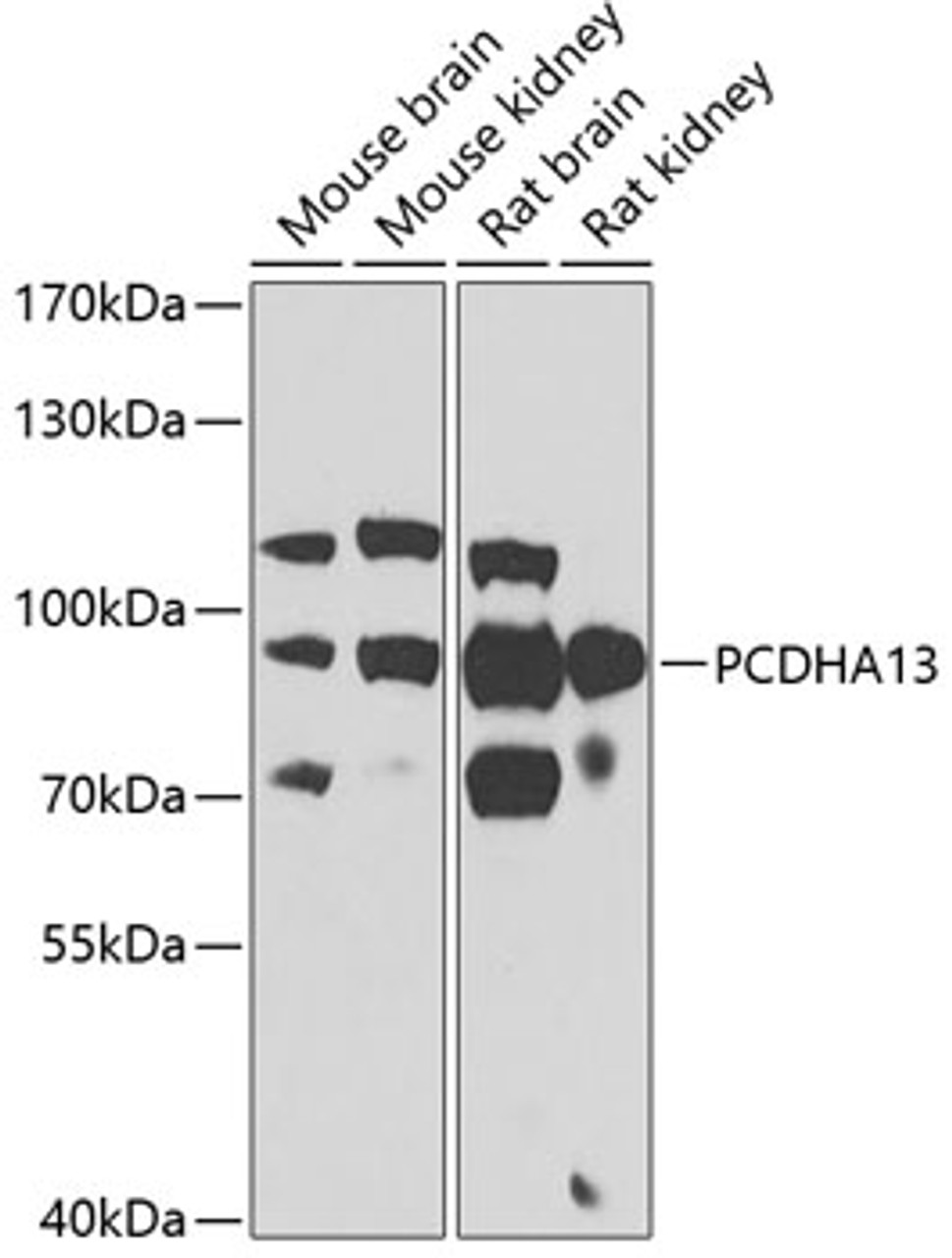 Western blot analysis of extracts of various cell lines, using PCDHA13 antibody (22-967) at 1:1000 dilution.<br/>Secondary antibody: HRP Goat Anti-Rabbit IgG (H+L) at 1:10000 dilution.<br/>Lysates/proteins: 25ug per lane.<br/>Blocking buffer: 3% nonfat dry milk in TBST.<br/>Detection: ECL Basic Kit.<br/>Exposure time: 90s.