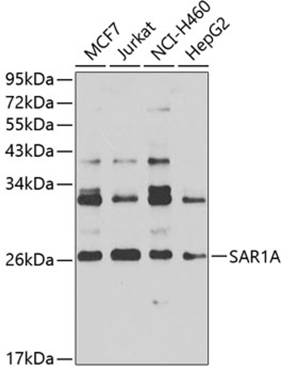 Western blot analysis of extracts of various cell lines, using SAR1A antibody (22-968) at 1:1000 dilution.<br/>Secondary antibody: HRP Goat Anti-Rabbit IgG (H+L) at 1:10000 dilution.<br/>Lysates/proteins: 25ug per lane.<br/>Blocking buffer: 3% nonfat dry milk in TBST.<br/>Detection: ECL Basic Kit.<br/>Exposure time: 30s.