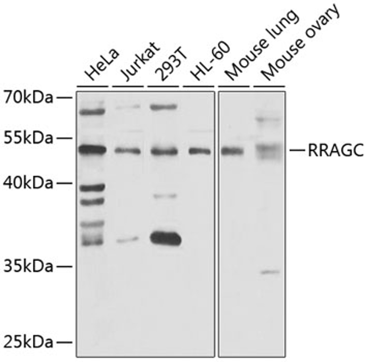 Western blot analysis of extracts of various cell lines, using RRAGC antibody (22-971) at 1:1000 dilution.<br/>Secondary antibody: HRP Goat Anti-Rabbit IgG (H+L) at 1:10000 dilution.<br/>Lysates/proteins: 25ug per lane.<br/>Blocking buffer: 3% nonfat dry milk in TBST.<br/>Detection: ECL Enhanced Kit.<br/>Exposure time: 30s.