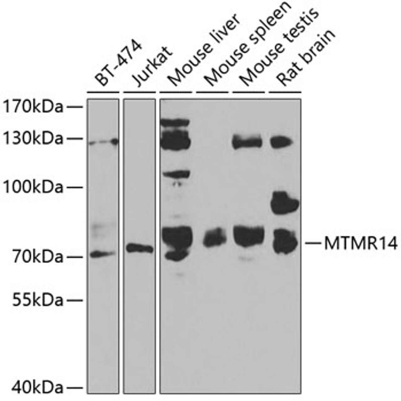 Western blot analysis of extracts of various cell lines, using MTMR14 antibody (22-972) at 1:1000 dilution.<br/>Secondary antibody: HRP Goat Anti-Rabbit IgG (H+L) at 1:10000 dilution.<br/>Lysates/proteins: 25ug per lane.<br/>Blocking buffer: 3% nonfat dry milk in TBST.<br/>Detection: ECL Basic Kit.<br/>Exposure time: 90s.