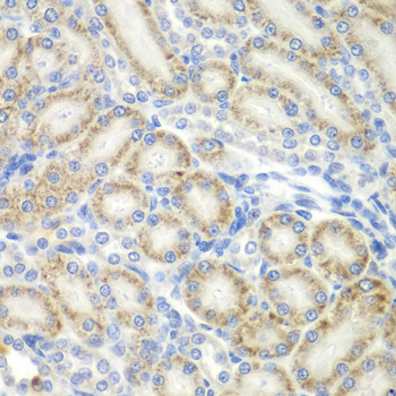 Immunohistochemistry of paraffin-embedded rat kidney using ASPSCR1 antibody (22-973) at dilution of 1:100 (40x lens) .