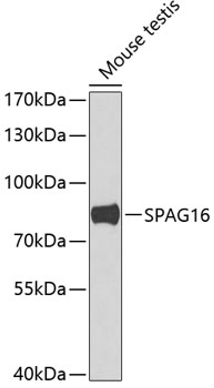 Western blot analysis of extracts of mouse testis, using SPAG16 antibody (22-974) at 1:1000 dilution.<br/>Secondary antibody: HRP Goat Anti-Rabbit IgG (H+L) at 1:10000 dilution.<br/>Lysates/proteins: 25ug per lane.<br/>Blocking buffer: 3% nonfat dry milk in TBST.<br/>Detection: ECL Basic Kit.<br/>Exposure time: 90s.