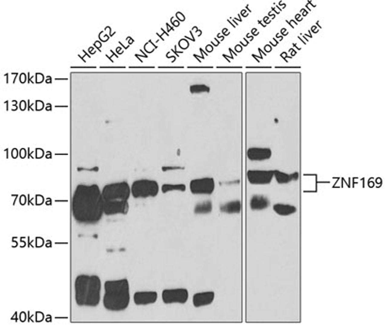 Western blot analysis of extracts of various cell lines, using ZNF169 antibody (22-977) at 1:1000 dilution.<br/>Secondary antibody: HRP Goat Anti-Rabbit IgG (H+L) at 1:10000 dilution.<br/>Lysates/proteins: 25ug per lane.<br/>Blocking buffer: 3% nonfat dry milk in TBST.<br/>Detection: ECL Basic Kit.<br/>Exposure time: 90s.