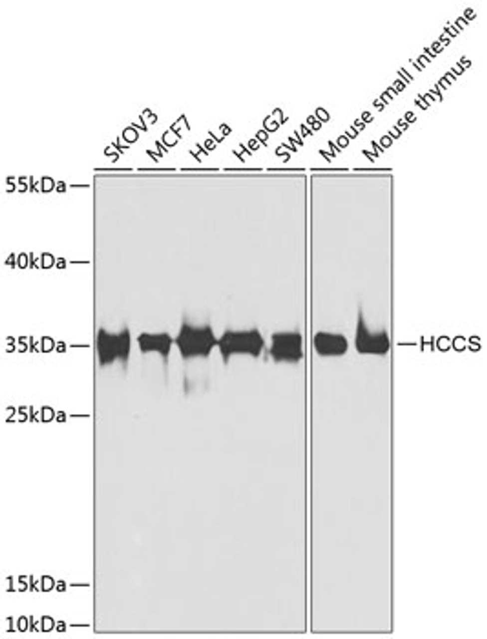 Western blot analysis of extracts of various cell lines, using HCCS antibody (22-979) at 1:1000 dilution.<br/>Secondary antibody: HRP Goat Anti-Rabbit IgG (H+L) at 1:10000 dilution.<br/>Lysates/proteins: 25ug per lane.<br/>Blocking buffer: 3% nonfat dry milk in TBST.<br/>Detection: ECL Basic Kit.<br/>Exposure time: 90s.