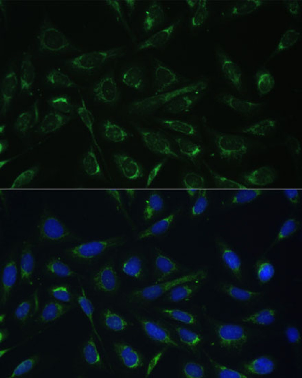 Immunofluorescence analysis of U-2 OS cells using HCCS Polyclonal Antibody (22-979) at dilution of 1:100 (40x lens) . Blue: DAPI for nuclear staining.