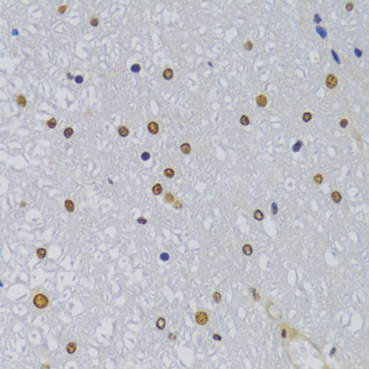 Immunohistochemistry of paraffin-embedded rat spinal cord using HNRNPA1 Antibody (22-980) at dilution of 1:100 (40x lens) .