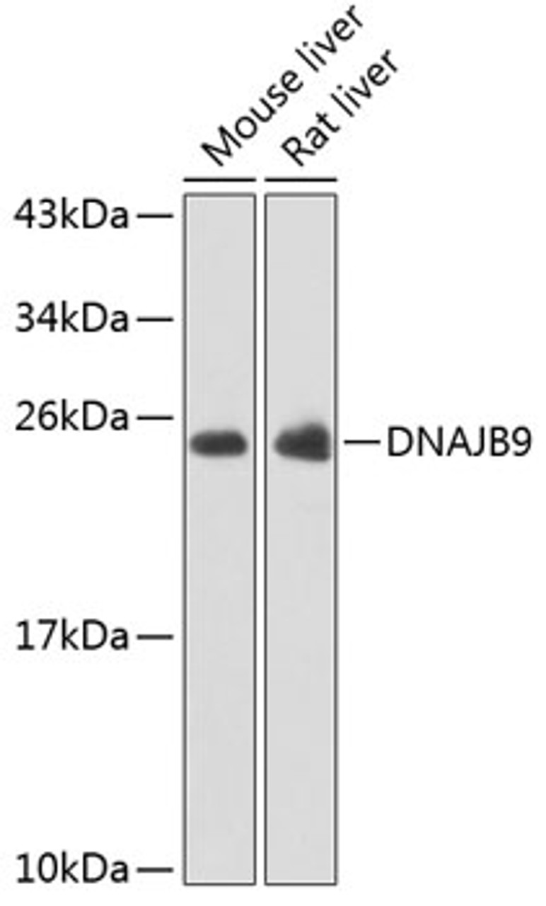 Western blot analysis of extracts of various cell lines, using DNAJB9 antibody (22-982) at 1:1000 dilution.<br/>Secondary antibody: HRP Goat Anti-Rabbit IgG (H+L) at 1:10000 dilution.<br/>Lysates/proteins: 25ug per lane.<br/>Blocking buffer: 3% nonfat dry milk in TBST.<br/>Detection: ECL Basic Kit.<br/>Exposure time: 10s.