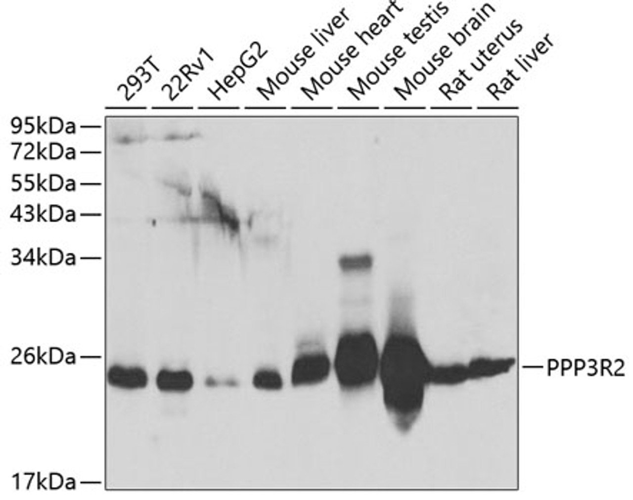 Western blot analysis of extracts of various cell lines, using PPP3R2 antibody (22-983) at 1:1000 dilution.<br/>Secondary antibody: HRP Goat Anti-Rabbit IgG (H+L) at 1:10000 dilution.<br/>Lysates/proteins: 25ug per lane.<br/>Blocking buffer: 3% nonfat dry milk in TBST.<br/>Detection: ECL Basic Kit.<br/>Exposure time: 90s.