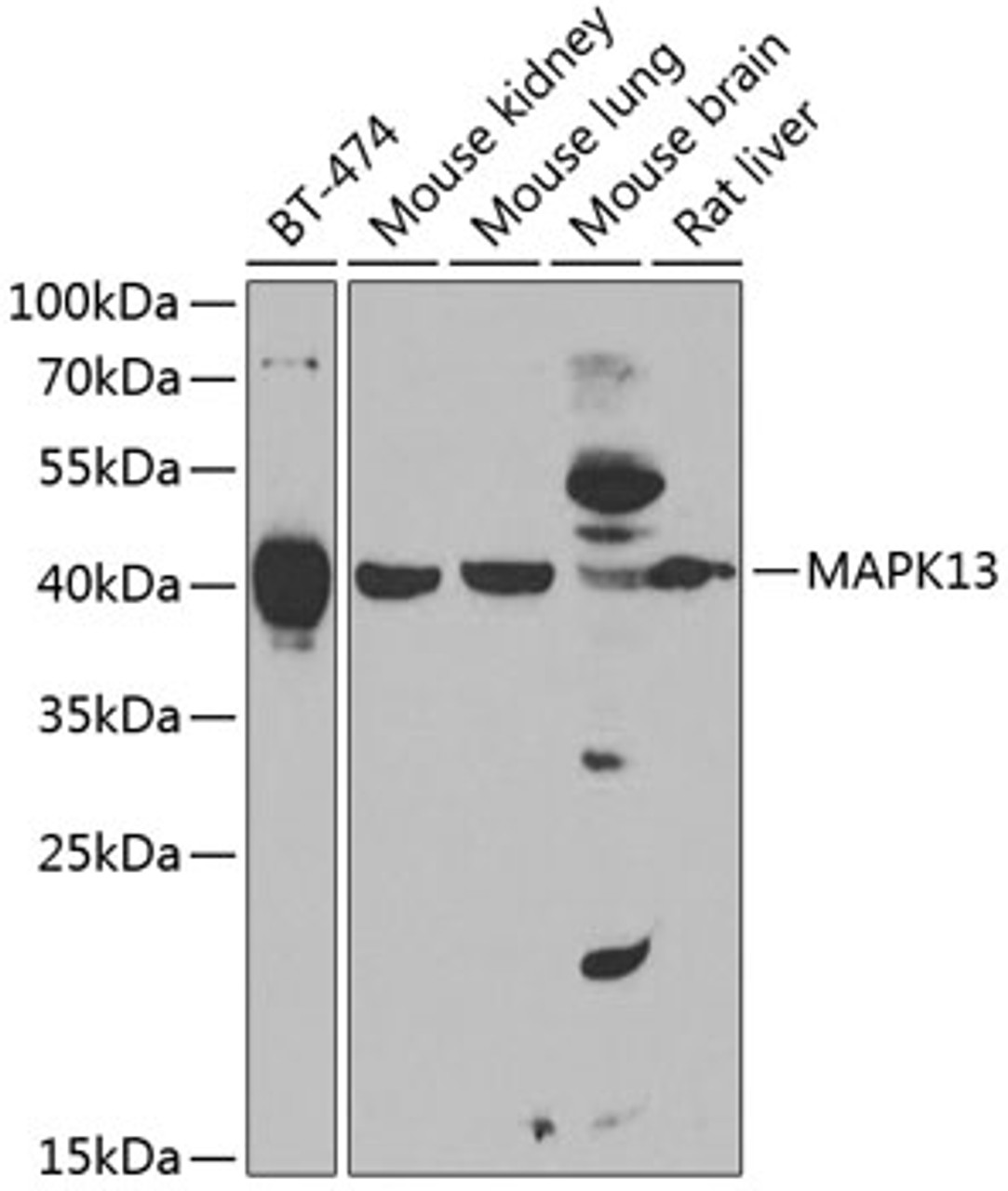 Western blot analysis of extracts of various cell lines, using MAPK13 antibody (22-984) at 1:1000 dilution._Secondary antibody: HRP Goat Anti-Rabbit IgG (H+L) at 1:10000 dilution._Lysates/proteins: 25ug per lane._Blocking buffer: 3% nonfat dry milk in TBST._Detection: ECL Enhanced Kit._Exposure time: 90s.