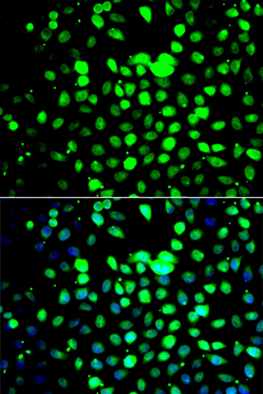 Immunofluorescence analysis of A549 cells using ZBTB25 antibody (22-988) . Blue: DAPI for nuclear staining.