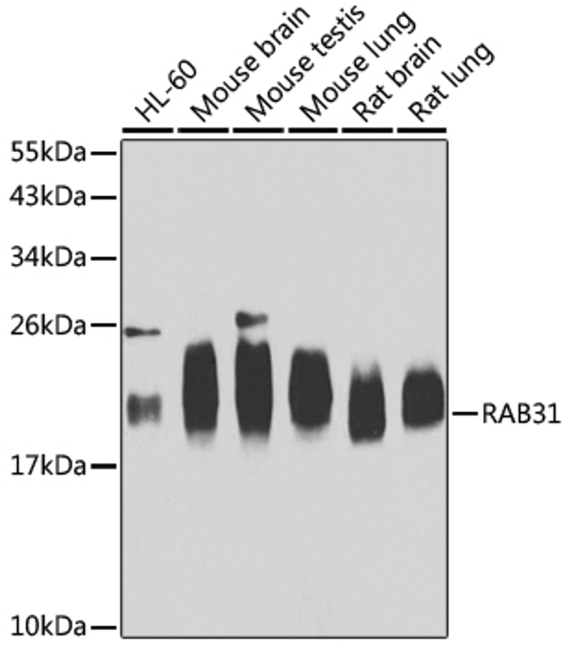 Western blot analysis of extracts of various cell lines, using RAB31 antibody (22-992) at 1:1000 dilution.<br/>Secondary antibody: HRP Goat Anti-Rabbit IgG (H+L) at 1:10000 dilution.<br/>Lysates/proteins: 25ug per lane.<br/>Blocking buffer: 3% nonfat dry milk in TBST.<br/>Detection: ECL Basic Kit.<br/>Exposure time: 30s.
