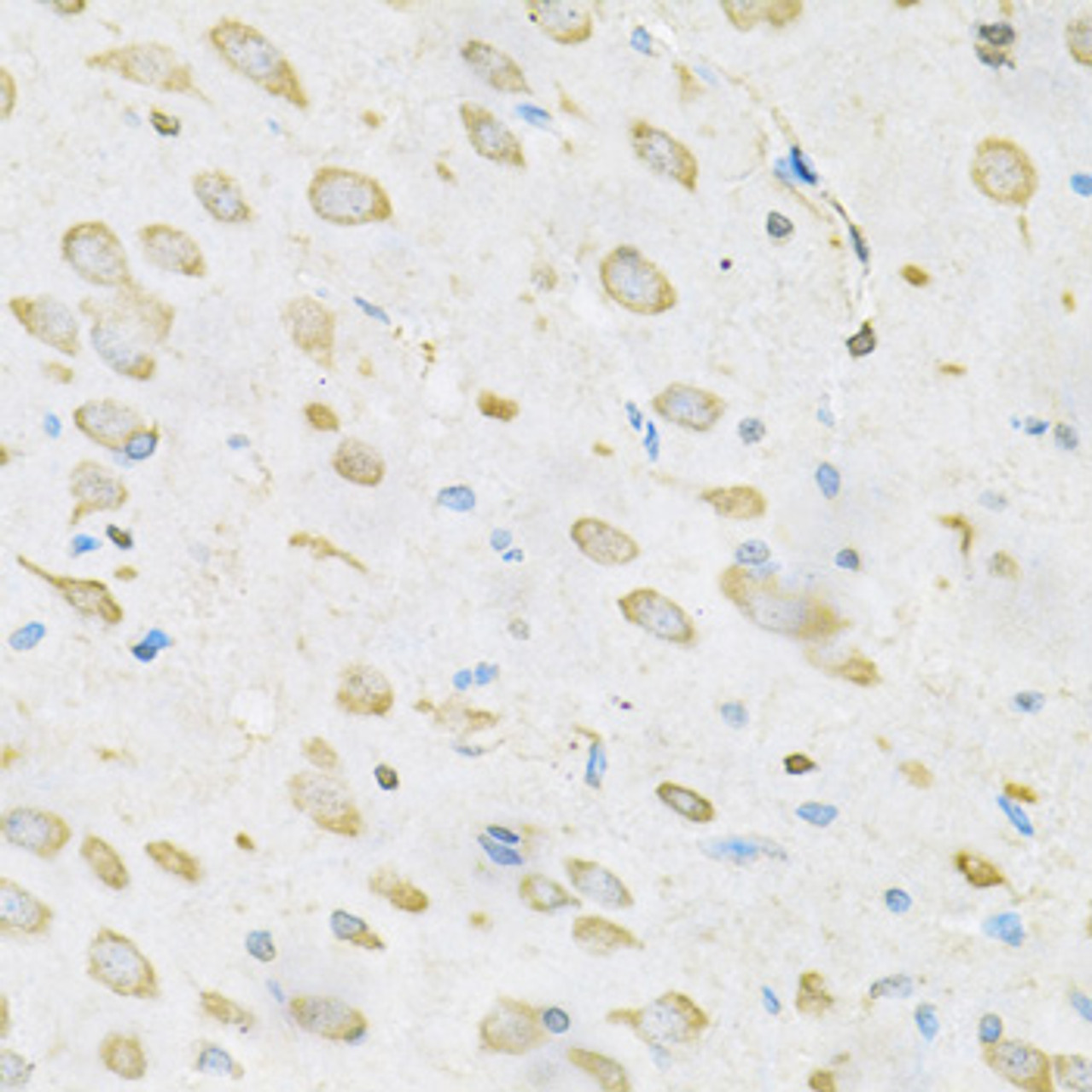 Immunohistochemistry of paraffin-embedded rat brain using TRIM29 Antibody (22-993) at dilution of 1:100 (40x lens) .