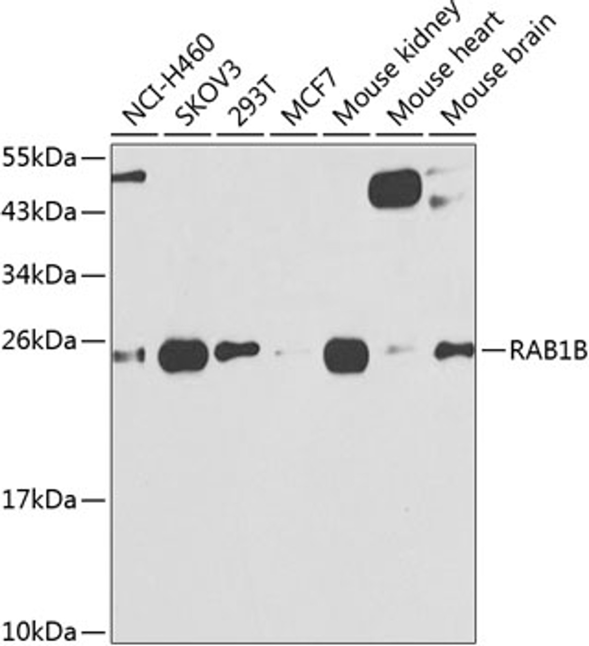 Western blot analysis of extracts of various cell lines, using RAB1B antibody (22-997) at 1:1000 dilution.<br/>Secondary antibody: HRP Goat Anti-Rabbit IgG (H+L) at 1:10000 dilution.<br/>Lysates/proteins: 25ug per lane.<br/>Blocking buffer: 3% nonfat dry milk in TBST.<br/>Detection: ECL Basic Kit.<br/>Exposure time: 90s.