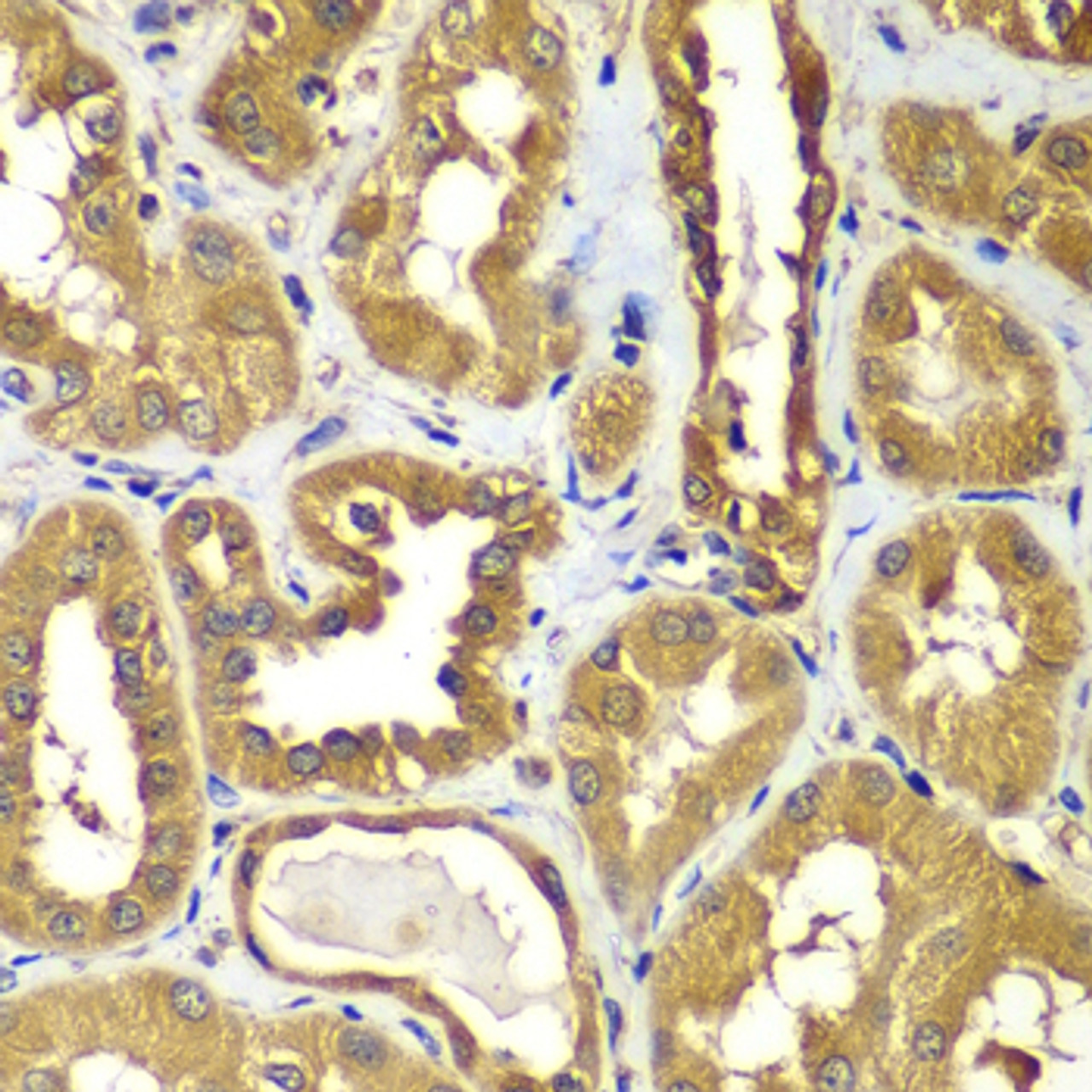Immunohistochemistry of paraffin-embedded human kidney using RAB1B antibody (22-997) at dilution of 1:100 (40x lens) .