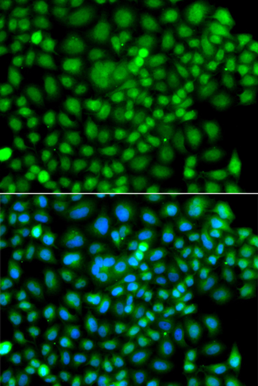 Immunofluorescence analysis of A549 cells using SUMO4 antibody (22-999) . Blue: DAPI for nuclear staining.
