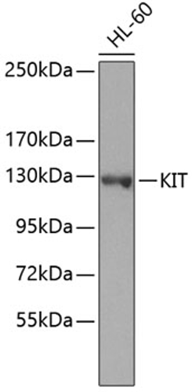 Western blot analysis of extracts of HL-60 cells, using KIT antibody (23-002) .<br/>Secondary antibody: HRP Goat Anti-Rabbit IgG (H+L) at 1:10000 dilution.<br/>Lysates/proteins: 25ug per lane.<br/>Blocking buffer: 3% nonfat dry milk in TBST.