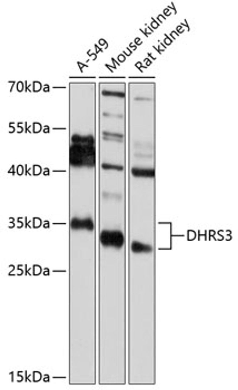 Western blot analysis of extracts of various cell lines, using DHRS3 antibody (23-007) at 1:2000 dilution.<br/>Secondary antibody: HRP Goat Anti-Rabbit IgG (H+L) at 1:10000 dilution.<br/>Lysates/proteins: 25ug per lane.<br/>Blocking buffer: 3% nonfat dry milk in TBST.<br/>Detection: ECL Basic Kit.<br/>Exposure time: 30s.