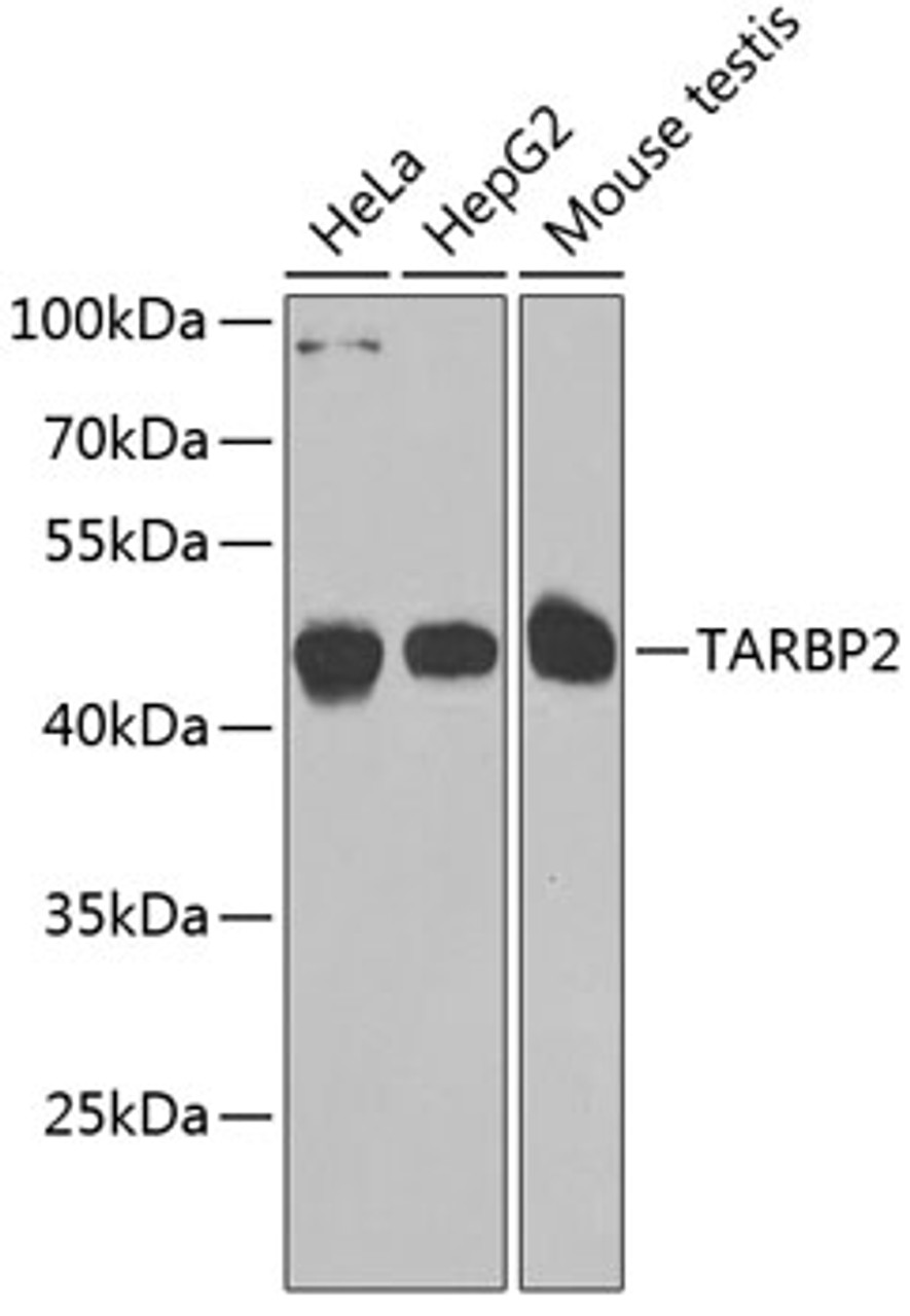 Western blot analysis of extracts of various cell lines, using TARBP2 antibody (23-010) at 1:1000 dilution.<br/>Secondary antibody: HRP Goat Anti-Rabbit IgG (H+L) at 1:10000 dilution.<br/>Lysates/proteins: 25ug per lane.<br/>Blocking buffer: 3% nonfat dry milk in TBST.<br/>Detection: ECL Basic Kit.<br/>Exposure time: 90s.