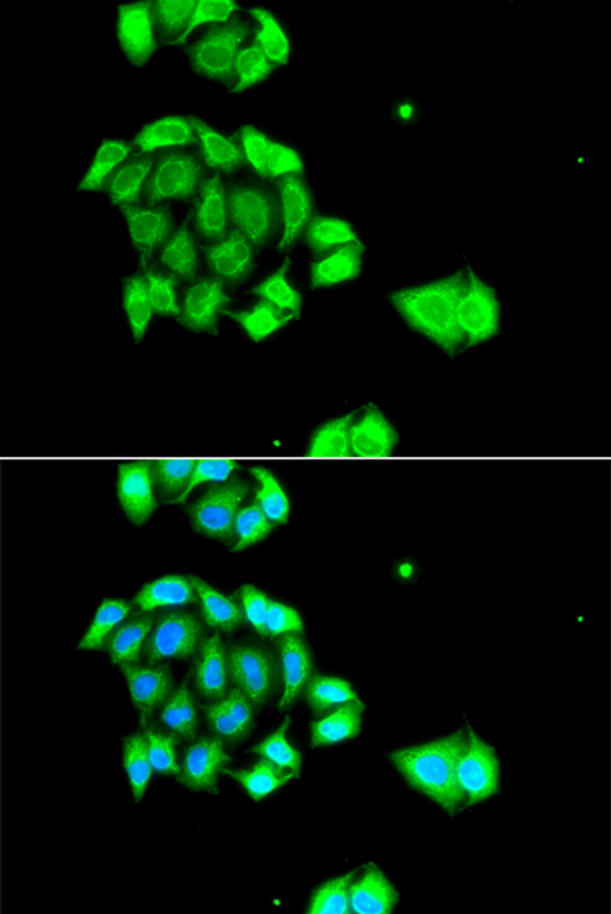 Immunofluorescence analysis of A549 cells using Rad51D antibody (23-011) . Blue: DAPI for nuclear staining.