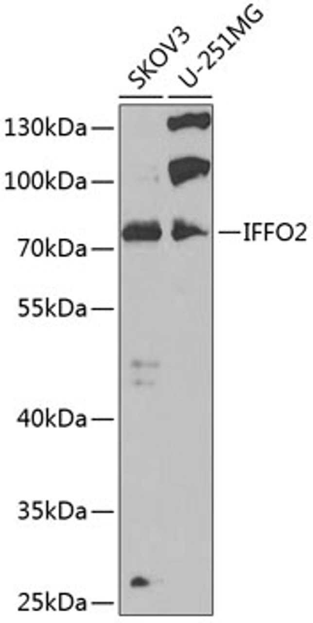 Western blot analysis of extracts of various cell lines, using IFFO2 antibody (23-016) at 1:1000 dilution.<br/>Secondary antibody: HRP Goat Anti-Rabbit IgG (H+L) at 1:10000 dilution.<br/>Lysates/proteins: 25ug per lane.<br/>Blocking buffer: 3% nonfat dry milk in TBST.<br/>Detection: ECL Basic Kit.<br/>Exposure time: 90s.