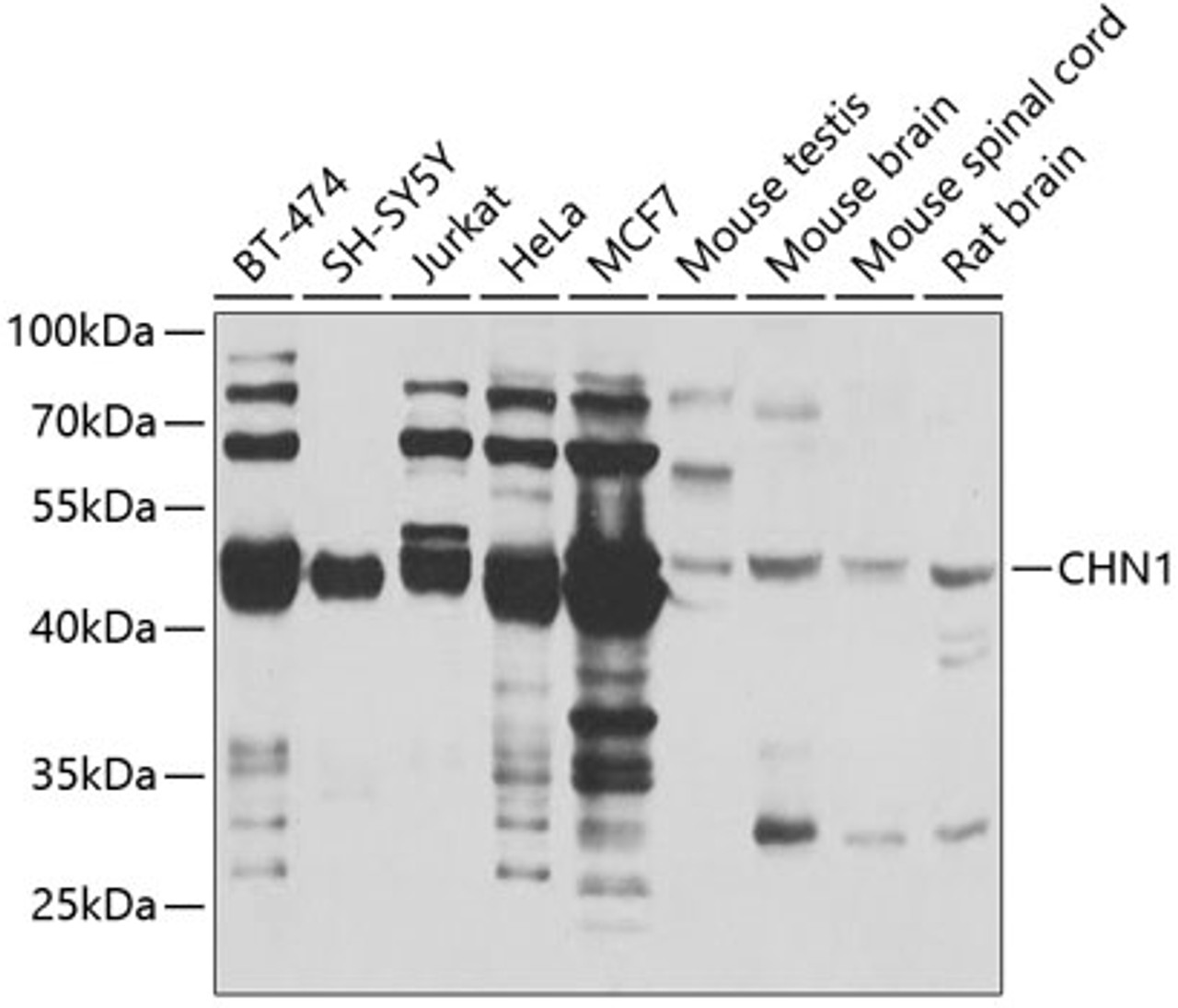 Western blot analysis of extracts of various cell lines, using CHN1 antibody (23-019) at 1:1000 dilution.<br/>Secondary antibody: HRP Goat Anti-Rabbit IgG (H+L) at 1:10000 dilution.<br/>Lysates/proteins: 25ug per lane.<br/>Blocking buffer: 3% nonfat dry milk in TBST.<br/>Detection: ECL Basic Kit.<br/>Exposure time: 5s.
