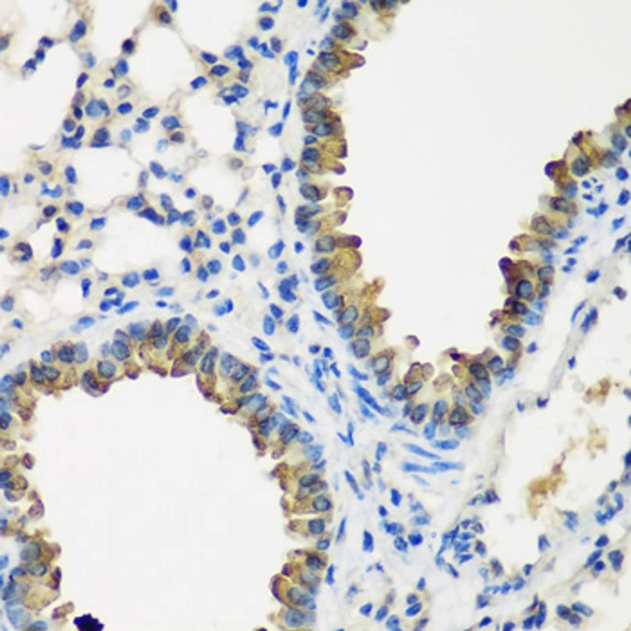 Immunohistochemistry of paraffin-embedded mouse lung using CYP2F1 antibody (23-021) at dilution of 1:200 (40x lens) .