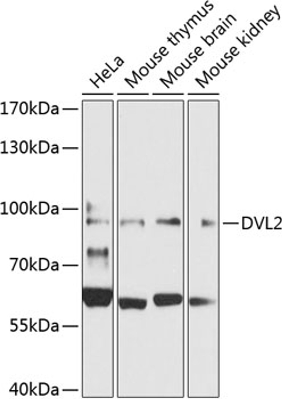Western blot analysis of extracts of various cell lines, using DVL2 Antibody (23-022) at 1:1000 dilution.<br/>Secondary antibody: HRP Goat Anti-Rabbit IgG (H+L) at 1:10000 dilution.<br/>Lysates/proteins: 25ug per lane.<br/>Blocking buffer: 3% nonfat dry milk in TBST.<br/>Detection: ECL Basic Kit.<br/>Exposure time: 30s.