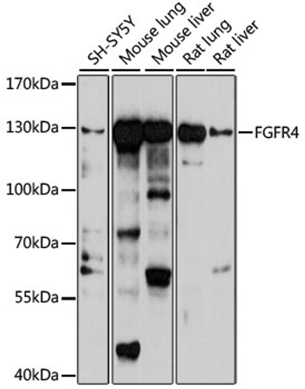 Western blot analysis of extracts of various cell lines, using FGFR4 antibody (23-024) at 1:1000 dilution.<br/>Secondary antibody: HRP Goat Anti-Rabbit IgG (H+L) at 1:10000 dilution.<br/>Lysates/proteins: 25ug per lane.<br/>Blocking buffer: 3% nonfat dry milk in TBST.<br/>Detection: ECL Basic Kit.<br/>Exposure time: 60s.