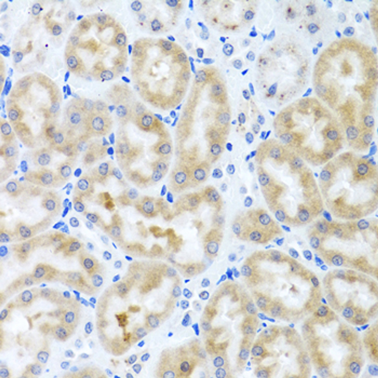 Immunohistochemistry of paraffin-embedded rat kidney using INHBC antibody (23-027) at dilution of 1:100 (40x lens) .