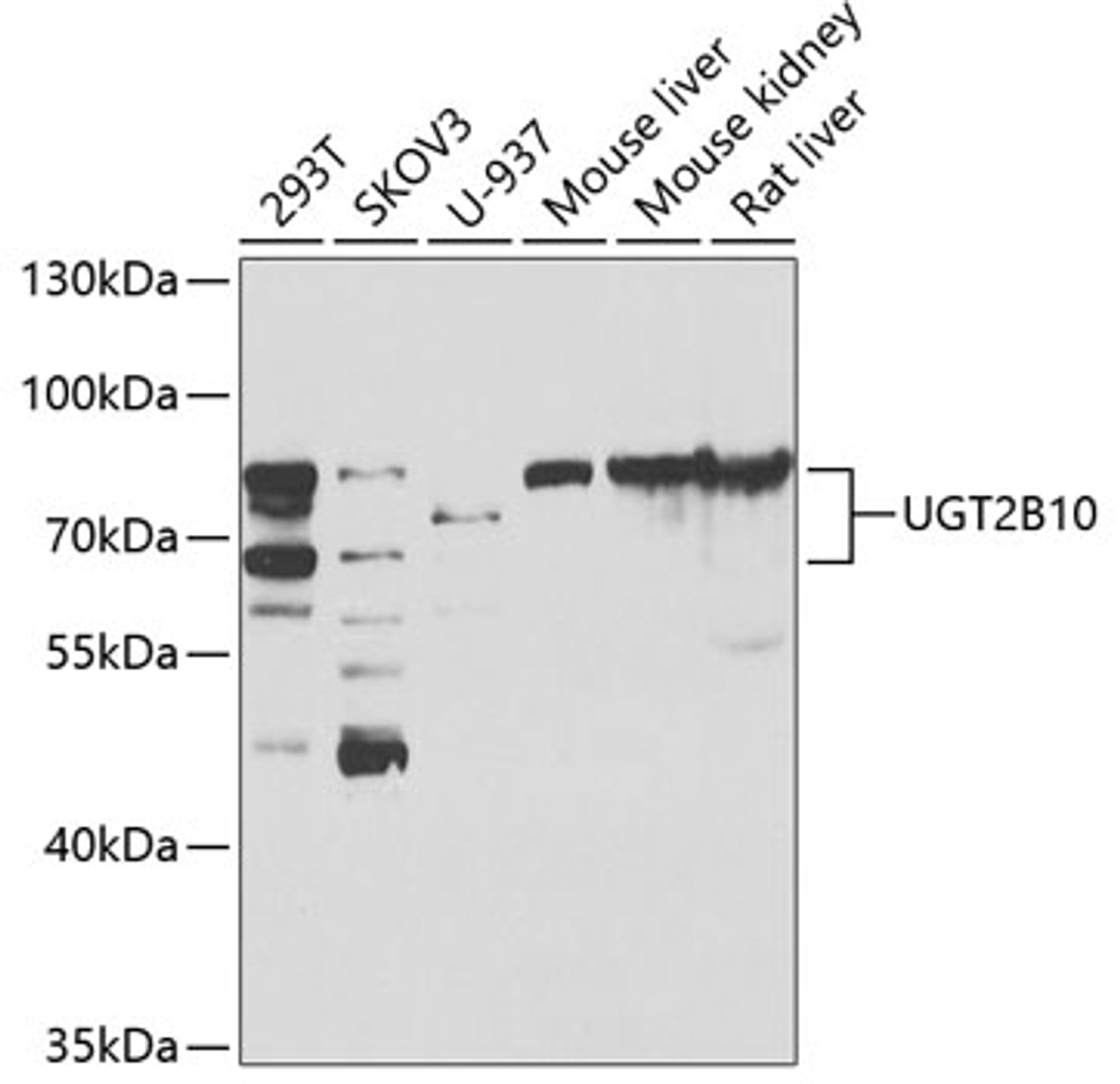 Western blot analysis of extracts of various cell lines, using UGT2B10 antibody (23-033) at 1:1000 dilution.<br/>Secondary antibody: HRP Goat Anti-Rabbit IgG (H+L) at 1:10000 dilution.<br/>Lysates/proteins: 25ug per lane.<br/>Blocking buffer: 3% nonfat dry milk in TBST.<br/>Detection: ECL Basic Kit.<br/>Exposure time: 90s.