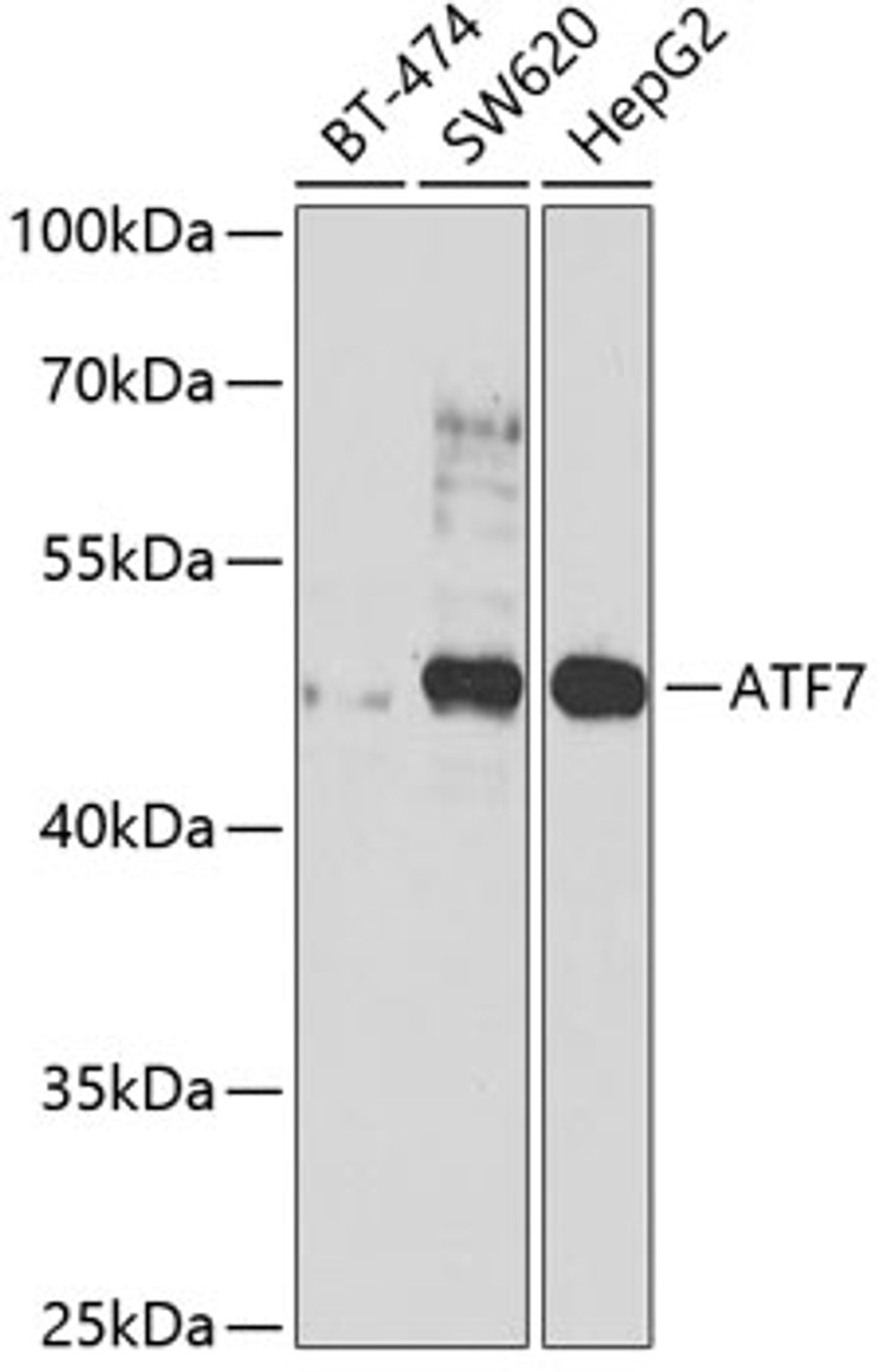 Western blot analysis of extracts of various cell lines, using ATF7 antibody (23-040) at 1:1000 dilution.<br/>Secondary antibody: HRP Goat Anti-Rabbit IgG (H+L) at 1:10000 dilution.<br/>Lysates/proteins: 25ug per lane.<br/>Blocking buffer: 3% nonfat dry milk in TBST.<br/>Detection: ECL Basic Kit.<br/>Exposure time: 90s.