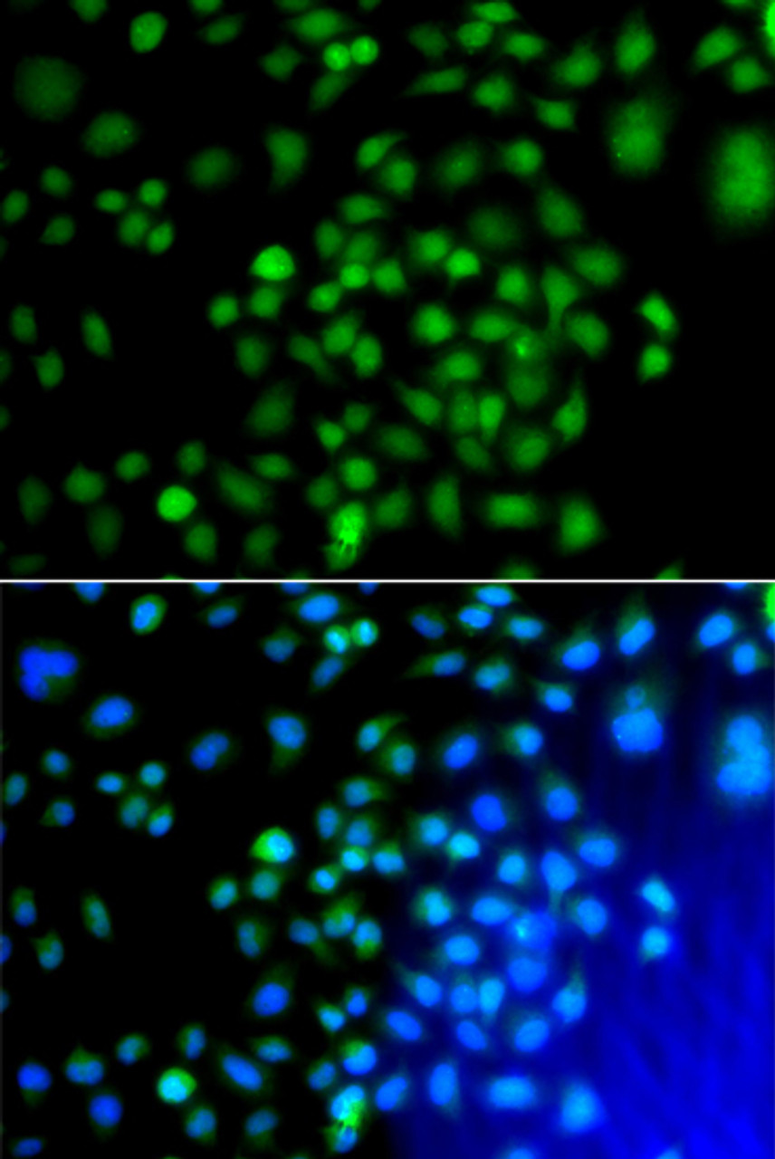 Immunofluorescence analysis of A549 cells using ATF7 antibody (23-040) . Blue: DAPI for nuclear staining.