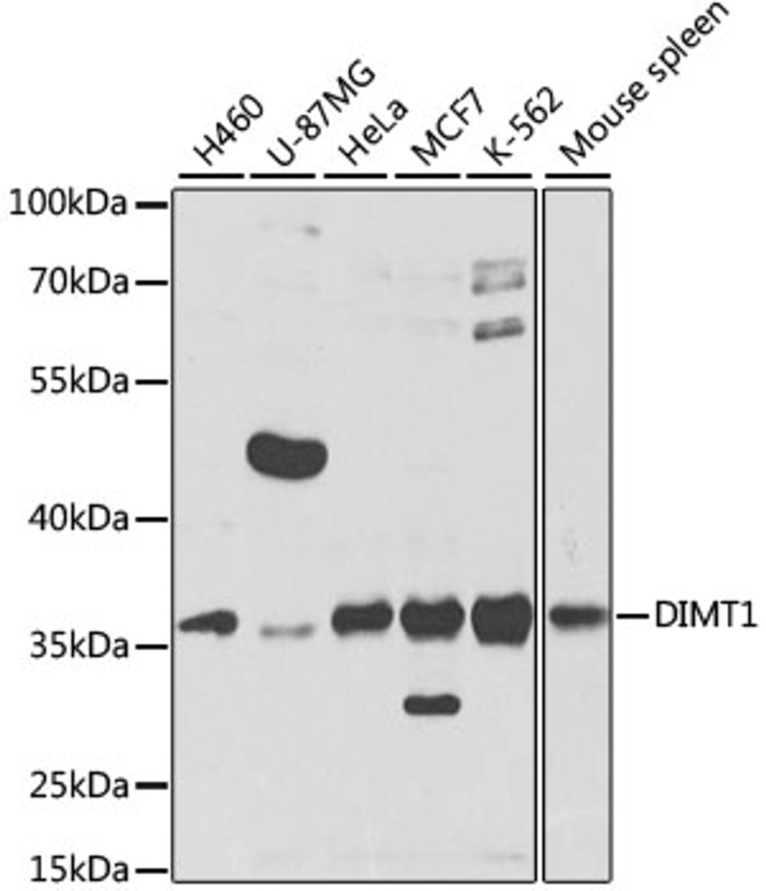 Western blot analysis of extracts of various cell lines, using DIMT1 antibody (23-045) at 1:1000 dilution.<br/>Secondary antibody: HRP Goat Anti-Rabbit IgG (H+L) at 1:10000 dilution.<br/>Lysates/proteins: 25ug per lane.<br/>Blocking buffer: 3% nonfat dry milk in TBST.<br/>Detection: ECL Basic Kit.<br/>Exposure time: 10s.