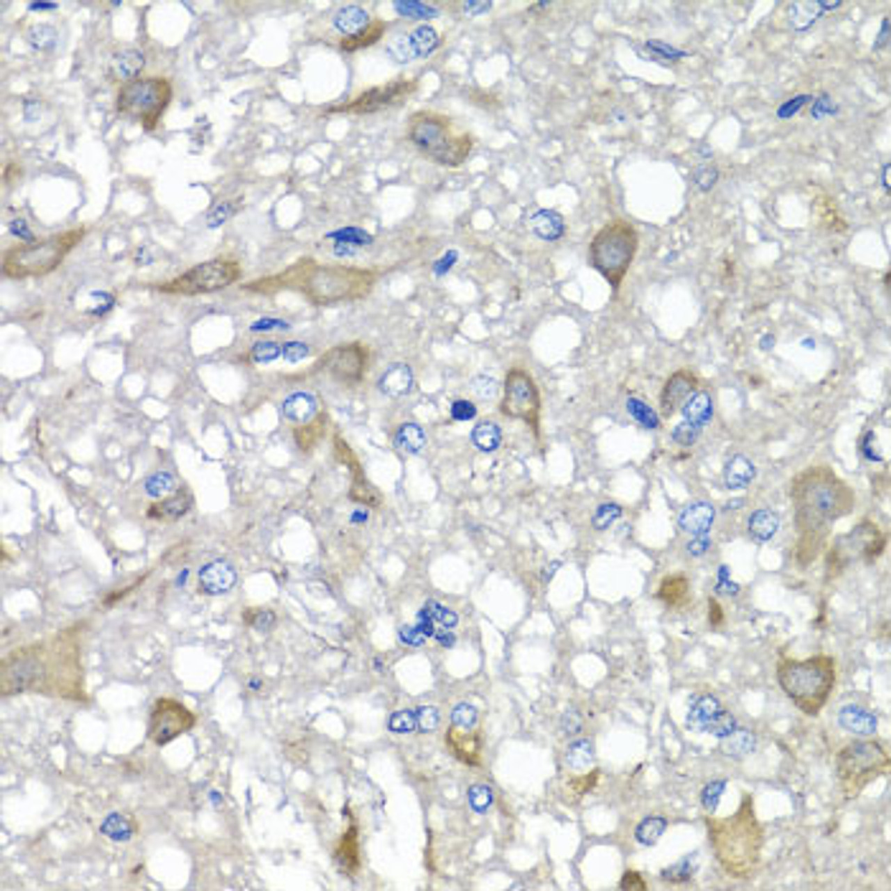 Immunohistochemistry of paraffin-embedded rat brain using C1GALT1C1 antibody (23-046) at dilution of 1:100 (40x lens) .