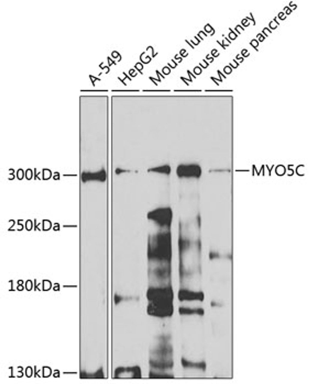 Western blot analysis of extracts of various cell lines, using MYO5C antibody (23-048) at 1:1000 dilution.<br/>Secondary antibody: HRP Goat Anti-Rabbit IgG (H+L) at 1:10000 dilution.<br/>Lysates/proteins: 25ug per lane.<br/>Blocking buffer: 3% nonfat dry milk in TBST.<br/>Detection: ECL Basic Kit.<br/>Exposure time: 90s.