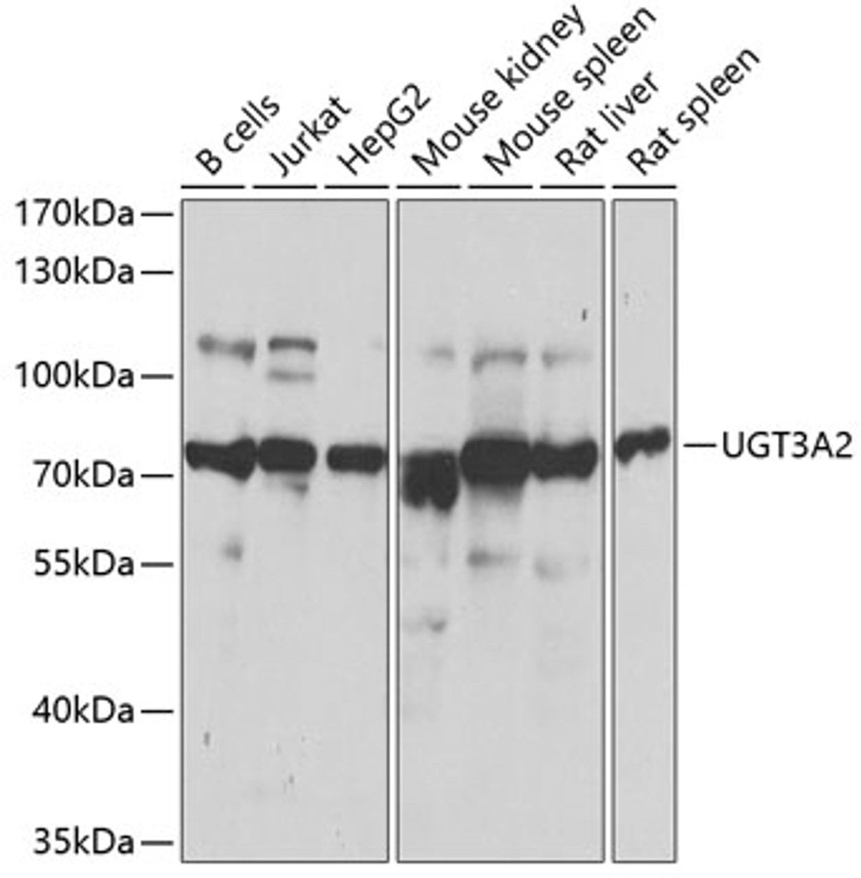Western blot analysis of extracts of various cell lines, using UGT3A2 antibody (23-054) at 1:1000 dilution.<br/>Secondary antibody: HRP Goat Anti-Rabbit IgG (H+L) at 1:10000 dilution.<br/>Lysates/proteins: 25ug per lane.<br/>Blocking buffer: 3% nonfat dry milk in TBST.<br/>Detection: ECL Basic Kit.<br/>Exposure time: 1s.