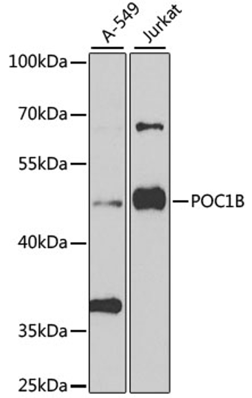 Western blot analysis of extracts of various cell lines, using POC1B antibody (23-058) at 1:1000 dilution.<br/>Secondary antibody: HRP Goat Anti-Rabbit IgG (H+L) at 1:10000 dilution.<br/>Lysates/proteins: 25ug per lane.<br/>Blocking buffer: 3% nonfat dry milk in TBST.<br/>Detection: ECL Basic Kit.<br/>Exposure time: 90s.