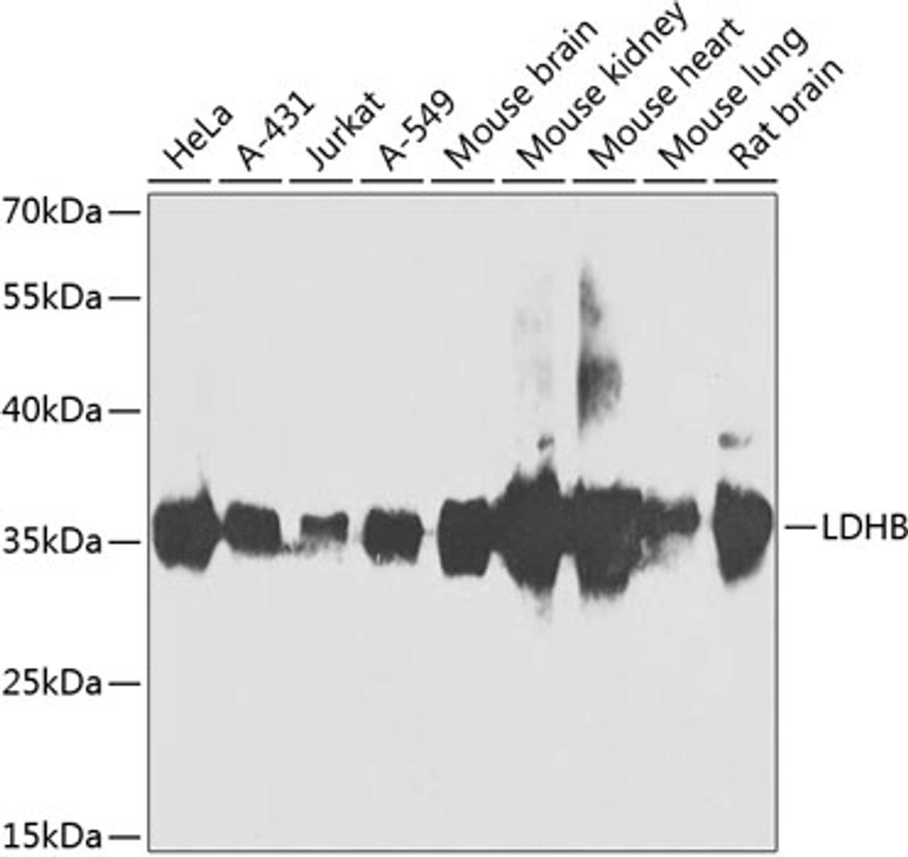 Western blot analysis of extracts of various cell lines, using LDHB antibody (23-061) at 1:1000 dilution.<br/>Secondary antibody: HRP Goat Anti-Rabbit IgG (H+L) at 1:10000 dilution.<br/>Lysates/proteins: 25ug per lane.<br/>Blocking buffer: 3% nonfat dry milk in TBST.<br/>Detection: ECL Basic Kit.<br/>Exposure time: 90s.