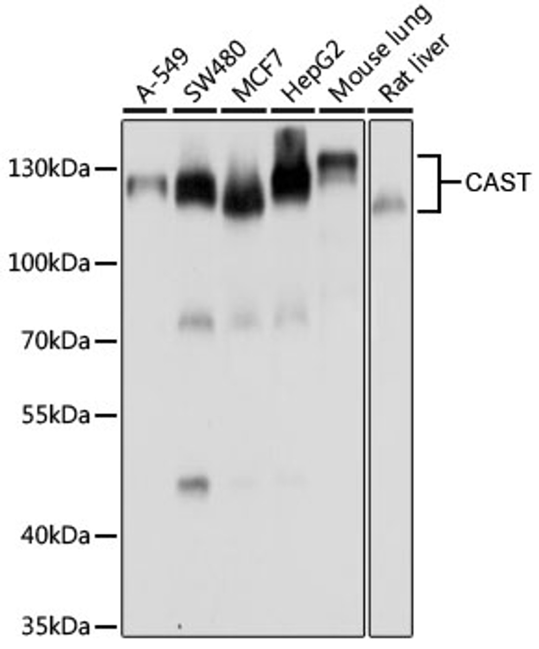 Western blot analysis of extracts of various cell lines, using CAST antibody (23-067) at 1:1000 dilution.<br/>Secondary antibody: HRP Goat Anti-Rabbit IgG (H+L) at 1:10000 dilution.<br/>Lysates/proteins: 25ug per lane.<br/>Blocking buffer: 3% nonfat dry milk in TBST.<br/>Detection: ECL Basic Kit.<br/>Exposure time: 5s.