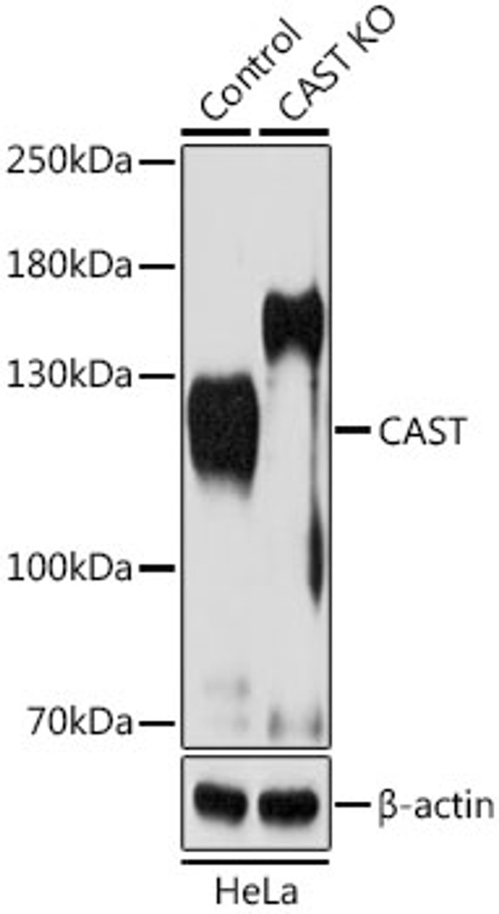 Western blot analysis of extracts from normal (control) and CAST knockout (KO) HeLa cells, using CAST antibody (23-067) at 1:1000 dilution.<br/>Secondary antibody: HRP Goat Anti-Rabbit IgG (H+L) at 1:10000 dilution.<br/>Lysates/proteins: 25ug per lane.<br/>Blocking buffer: 3% nonfat dry milk in TBST.<br/>Detection: ECL Basic Kit.<br/>Exposure time: 1s.