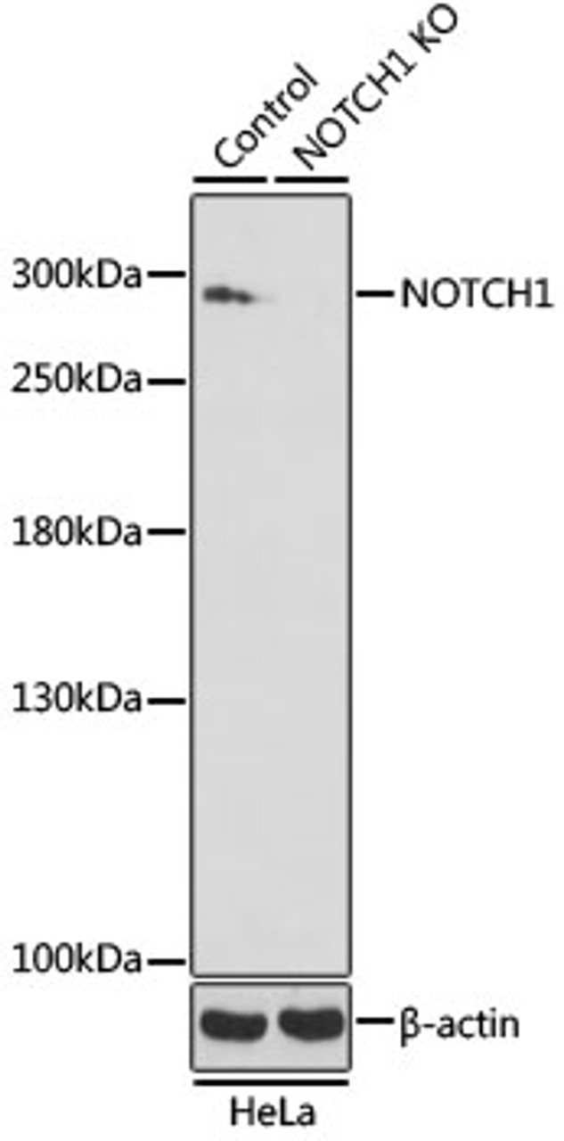Western blot analysis of extracts from normal (control) and NOTCH1 knockout (KO) HeLa cells, using NOTCH1 antibody (23-069) at 1:500 dilution.<br/>Secondary antibody: HRP Goat Anti-Rabbit IgG (H+L) at 1:10000 dilution.<br/>Lysates/proteins: 25ug per lane.<br/>Blocking buffer: 3% nonfat dry milk in TBST.<br/>Detection: ECL Basic Kit.<br/>Exposure time: 90s.