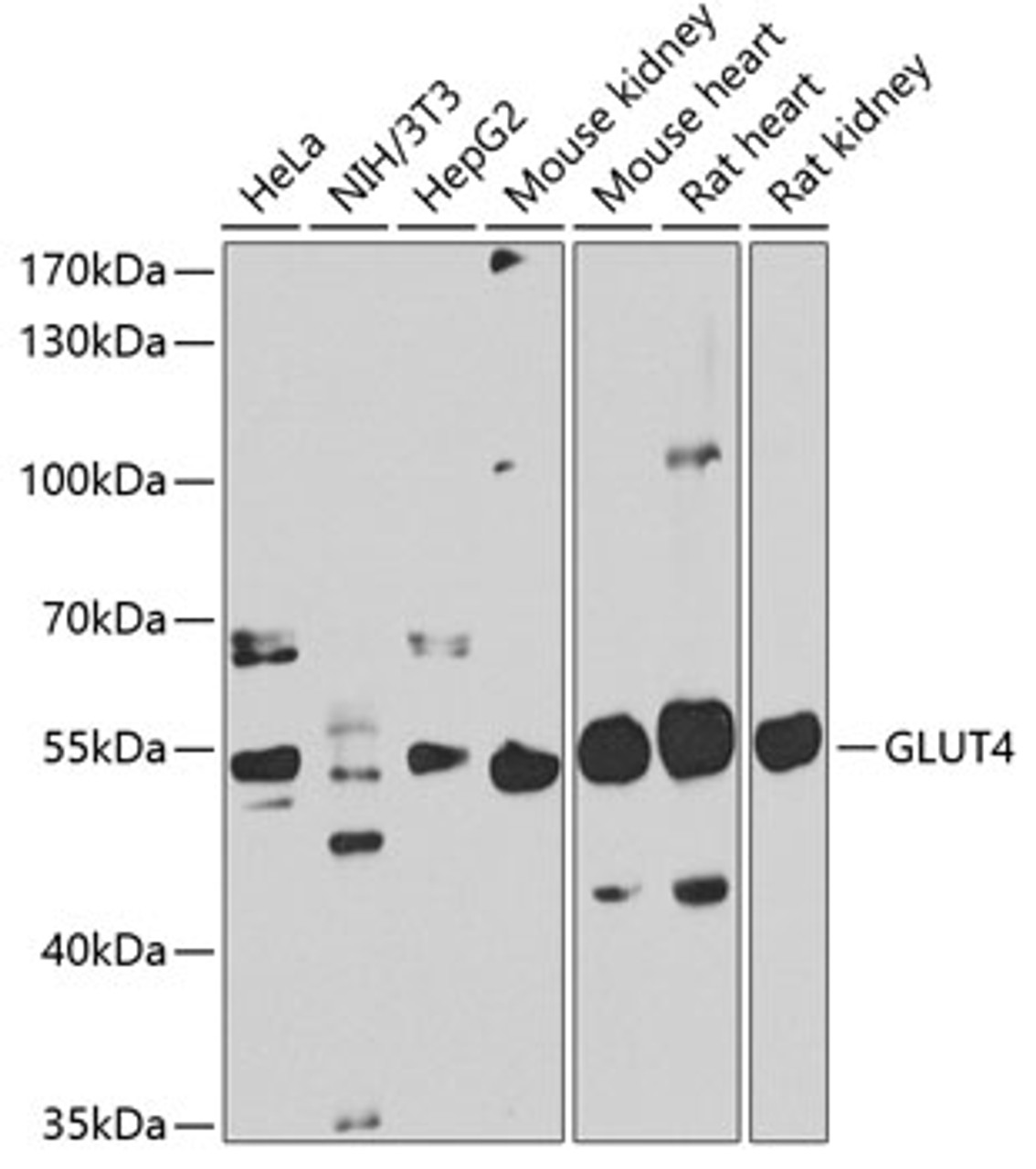 Western blot analysis of extracts of various cell lines, using GLUT4 antibody (23-070) at 1:1000 dilution.<br/>Secondary antibody: HRP Goat Anti-Rabbit IgG (H+L) at 1:10000 dilution.<br/>Lysates/proteins: 25ug per lane.<br/>Blocking buffer: 3% nonfat dry milk in TBST.<br/>Detection: ECL Basic Kit.<br/>Exposure time: 90s.