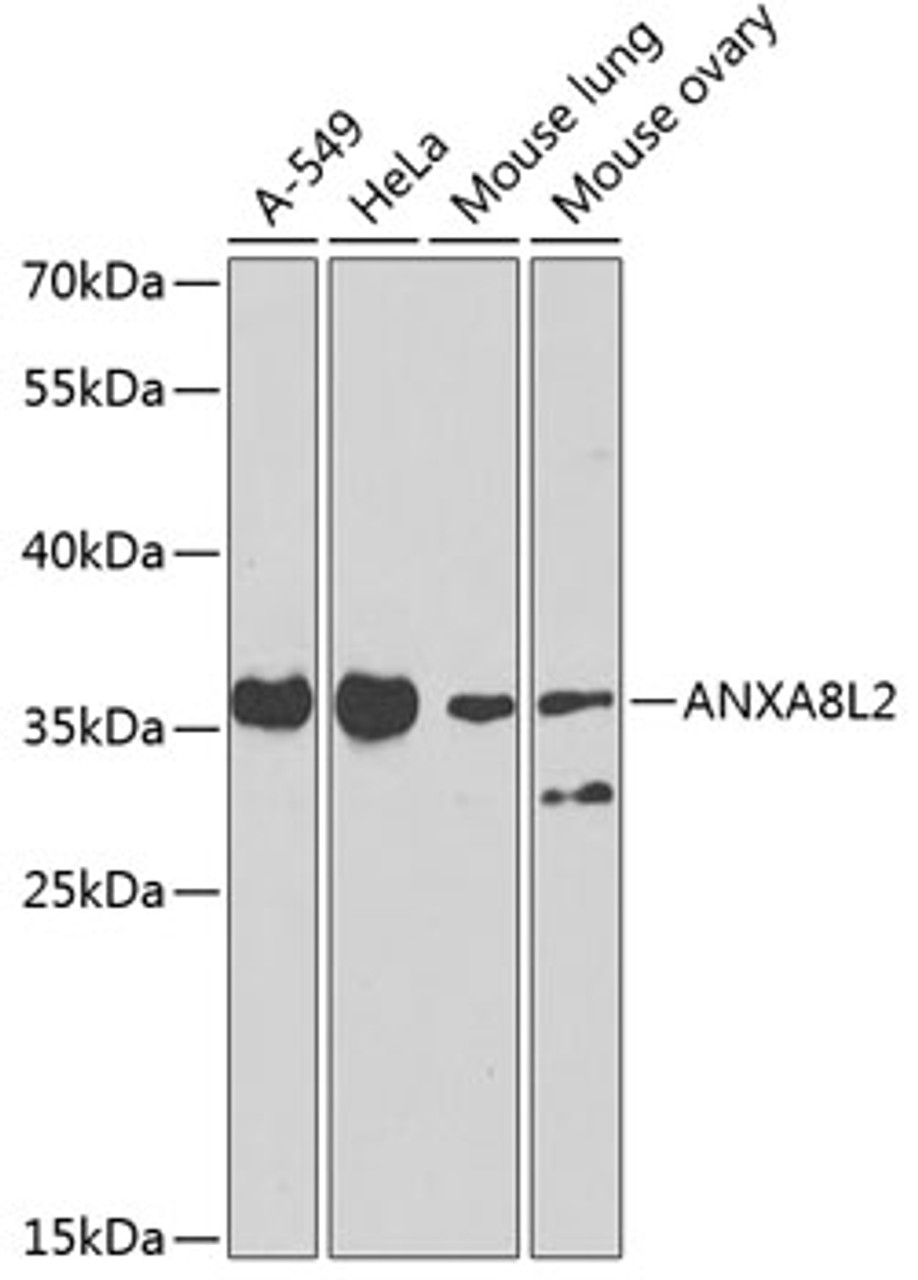 Western blot analysis of extracts of various cell lines, using ANXA8L2 antibody (23-073) at 1:1000 dilution.<br/>Secondary antibody: HRP Goat Anti-Rabbit IgG (H+L) at 1:10000 dilution.<br/>Lysates/proteins: 25ug per lane.<br/>Blocking buffer: 3% nonfat dry milk in TBST.<br/>Detection: ECL Basic Kit.<br/>Exposure time: 90s.