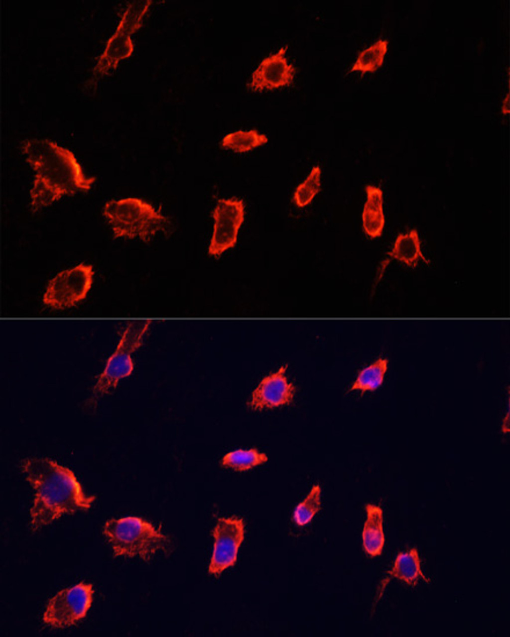 Immunofluorescence analysis of HeLa cells using ARF1 antibody (23-074) at dilution of 1:100. Blue: DAPI for nuclear staining.
