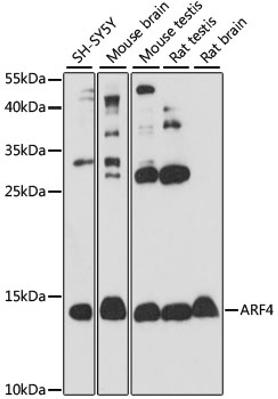 Western blot analysis of extracts of various cell lines, using ARF4 antibody (23-075) at 1:1000 dilution.<br/>Secondary antibody: HRP Goat Anti-Rabbit IgG (H+L) at 1:10000 dilution.<br/>Lysates/proteins: 25ug per lane.<br/>Blocking buffer: 3% nonfat dry milk in TBST.<br/>Detection: ECL Basic Kit.<br/>Exposure time: 30s.