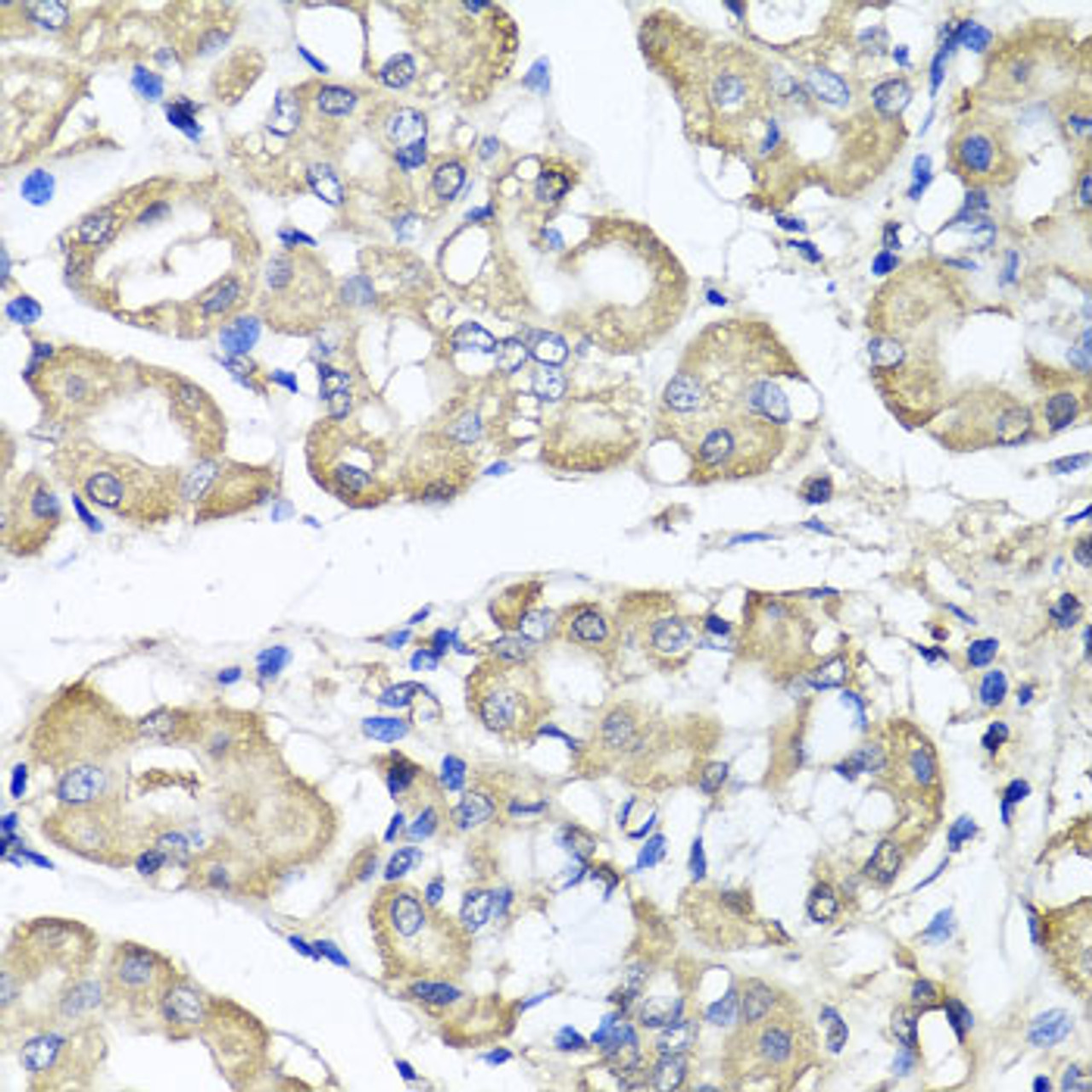 Immunohistochemistry of paraffin-embedded human stomach using BCS1L antibody (23-078) at dilution of 1:100 (40x lens) .